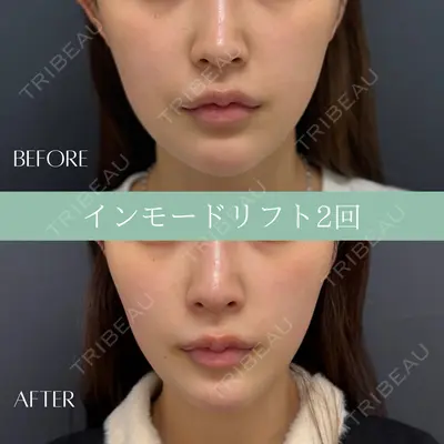 RIVER CLINIC（リバークリニック）大阪院の症例