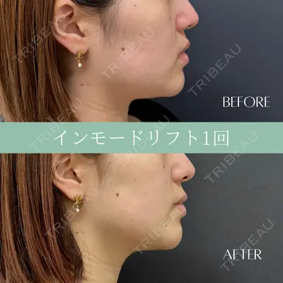RIVER CLINIC（リバークリニック）大阪院の症例
