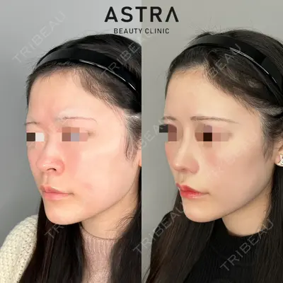 ASTRA BEAUTY CLINIC 塩満 惠子医師の症例