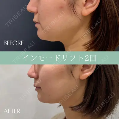 RIVER CLINIC（リバークリニック）大阪院の症例