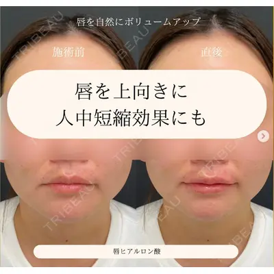 自由が丘ウェルエイジングビューティークリニックの症例
