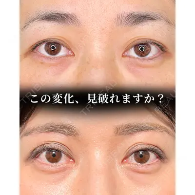 東京シンデレラ美容外科 大宮院 竹田 昌平医師の症例
