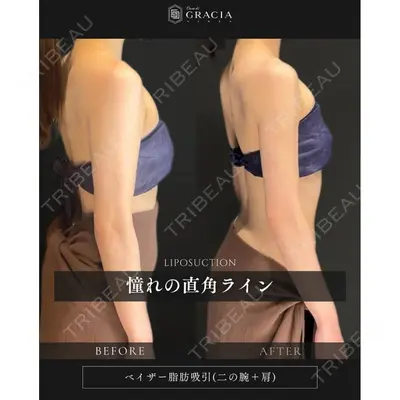 Casa de GRACIA GINZA 【カーサデグラシアギンザ】 吉田 直樹医師の症例