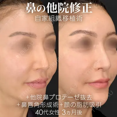 ジョウクリニック 銀座院 重本　譲医師の症例