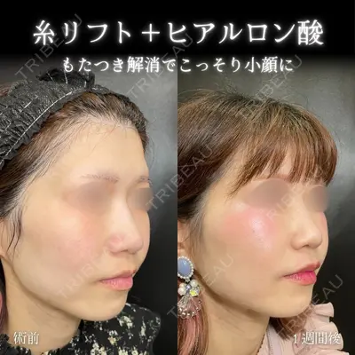 eクリニック 大阪梅田 西日本統括院 脇谷 雄一朗医師の症例