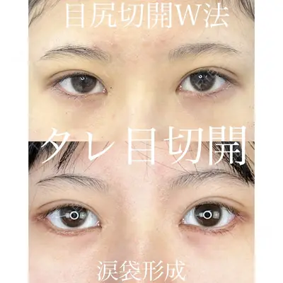 ルラ美容クリニック 渋谷本院 武内 大医師の症例