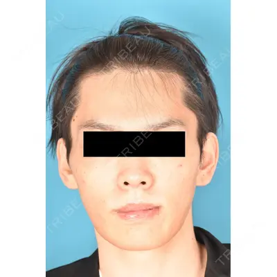 アネシス美容クリニック 水野　力医師の症例