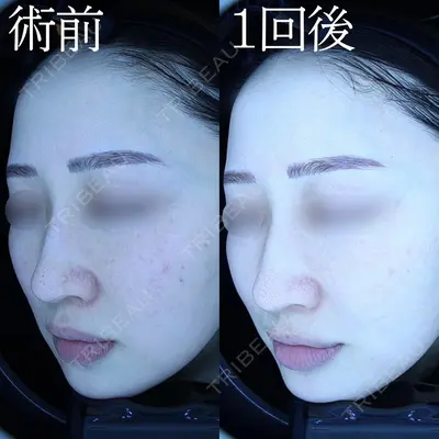 HAAB BEAUTY CLINIC 名古屋院の症例
