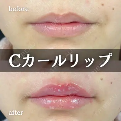 ルラ美容クリニック 新宿院 陶 美梨医師の症例