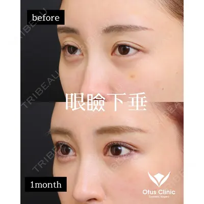 Otus Clinic 【オータスクリニック】 中 徳太郎医師の症例