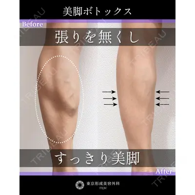 東京形成美容外科 船橋院の症例