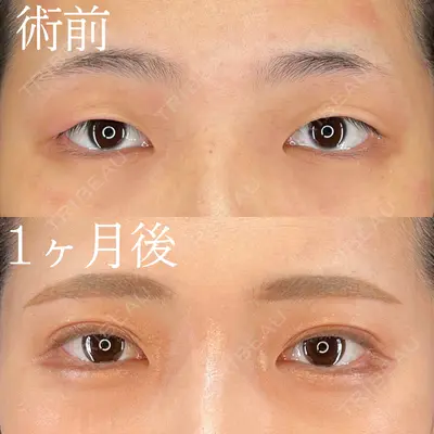 HAAB×DREAM BEAUTY CLINIC 大阪梅田院 柏木 太雅医師の症例