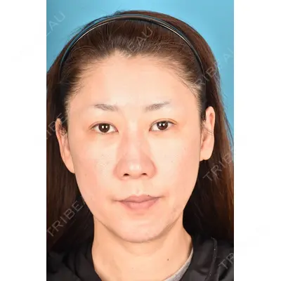 アネシス美容クリニック 水野　力医師の症例