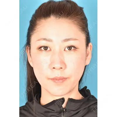 アネシス美容クリニック 水野　力医師の症例