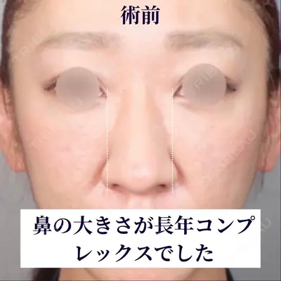 ネビュラクリニック 京都院 岸 大輔医師の症例