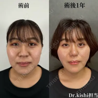 ネビュラクリニック 京都院 岸 大輔医師の症例