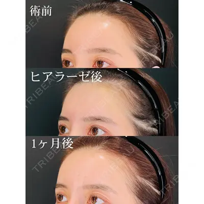 HAAB×DREAM BEAUTY CLINIC 大阪梅田院 鈴木 馨斗医師の症例