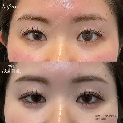 DMTC CLINIC 日本橋院の症例