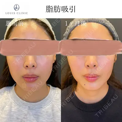 LOUIS CLINIC 二子玉川院【ルイクリニック】 小松 塁医師の症例