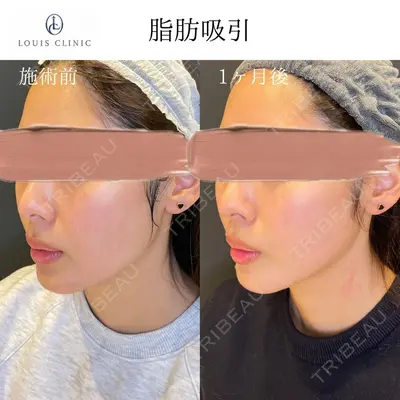 LOUIS CLINIC 二子玉川院【ルイクリニック】 小松 塁医師の症例