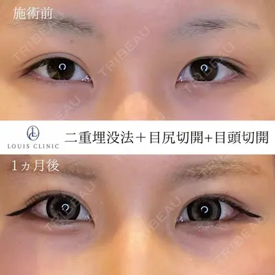 LOUIS CLINIC 二子玉川院【ルイクリニック】 小松 塁医師の症例