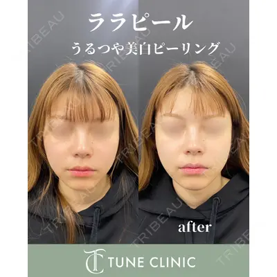 TUNE CLINIC【チューンクリニック】の症例