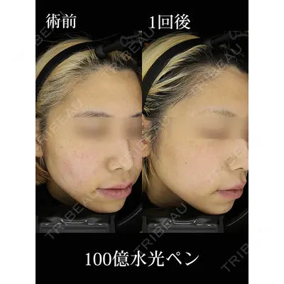 HAAB×DREAM BEAUTY CLINIC 東京本院の症例