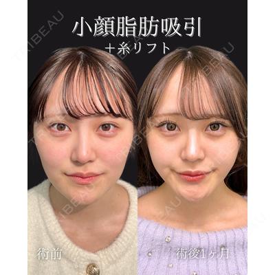 東京シンデレラ美容外科 池袋院 石井 達也医師の症例