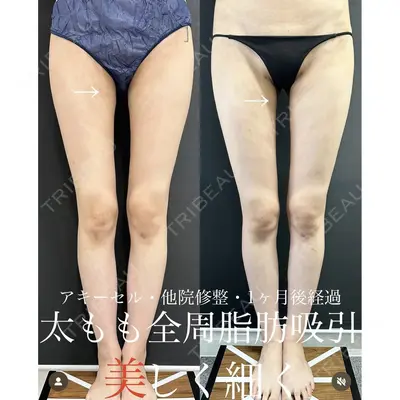 ルラ美容クリニック 渋谷本院 武内 大医師の症例