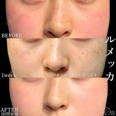 Code Beauty Clinic 名古屋院 橋本 祥平医師の症例