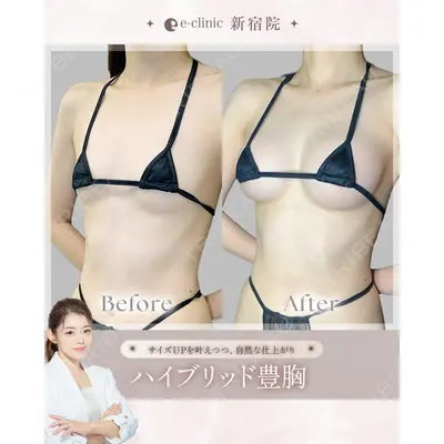 eクリニック 新宿院 田中 里佳医師の症例