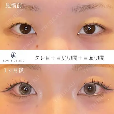 LOUIS CLINIC 二子玉川院【ルイクリニック】 小松 塁医師の症例