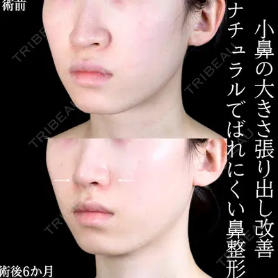 アリエル美容クリニック 大宮院 阪野 一世医師の症例