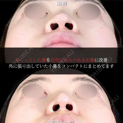 アリエル美容クリニック 大宮院 鈴木　桂介医師の症例