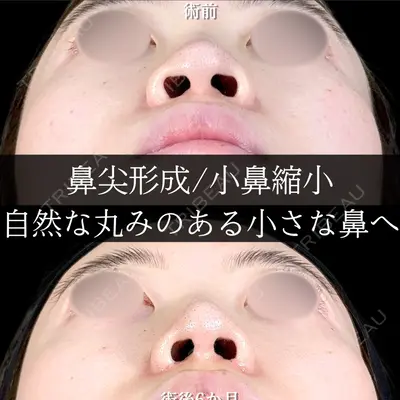 アリエル美容クリニック 大宮院 鈴木　桂介医師の症例