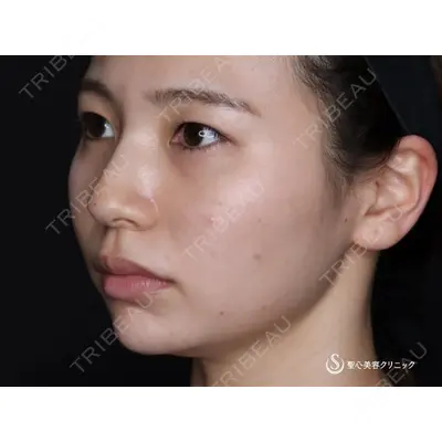 聖心美容クリニック 大阪院 寺町 英明医師の症例