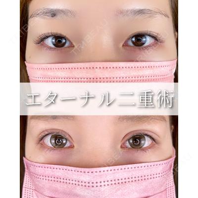 ルラ美容クリニック 大阪本院 平田 一記医師の症例