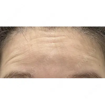X CLINIC 恵比寿院 辻村 梢医師の症例