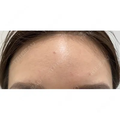 X CLINIC 恵比寿院 辻村 梢医師の症例