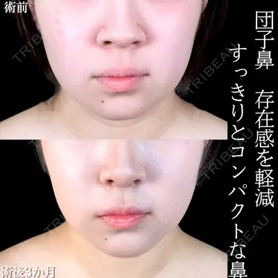 アリエル美容クリニック 大宮院 阪野 一世医師の症例