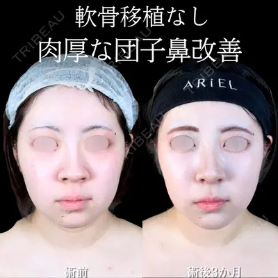 アリエル美容クリニック 大宮院 阪野 一世医師の症例