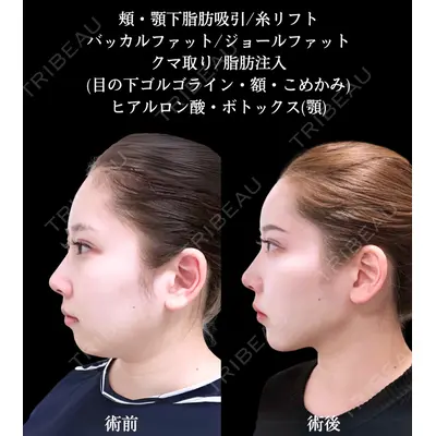 アリエル美容クリニック 大宮院 鈴木　桂介医師の症例