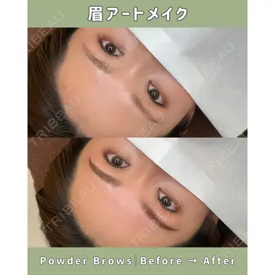 Belle Via Clinic 森田 佑望医師の症例