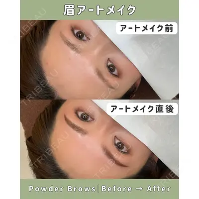 Belle Via Clinic 森田 佑望医師の症例