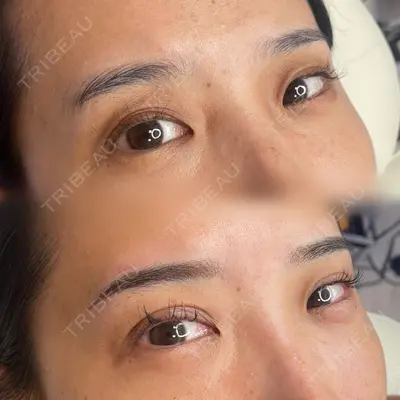 Tokyo Tensei Clinic 新宿院 斉藤美優医師の症例