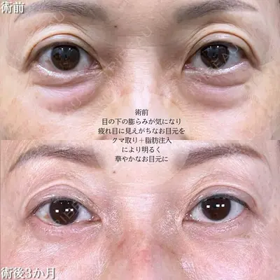 アリエル美容クリニック 大宮院 鈴木　桂介医師の症例