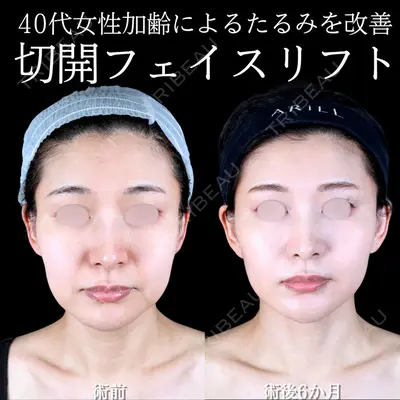 アリエル美容クリニック 大宮院 阪野 一世医師の症例