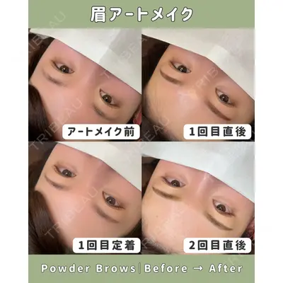 Belle Via Clinic 森田 佑望医師の症例