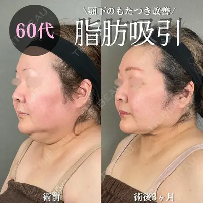アリエル美容クリニック 大宮院 鈴木　桂介医師の症例