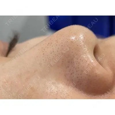 X CLINIC 恵比寿院 辻村 梢医師の症例